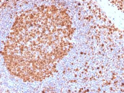 Immunohistochemistry-Paraffin: MCM7 Antibody (MCM7/2832R) - Azide and BSA Free [NBP3-08405]