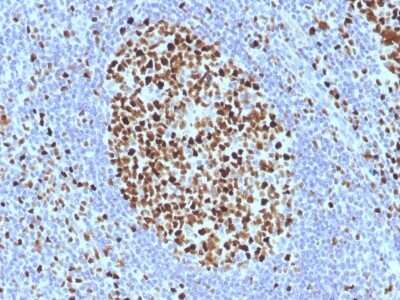 Immunohistochemistry-Paraffin: MCM7 Antibody (SPM379) [NBP2-53219]
