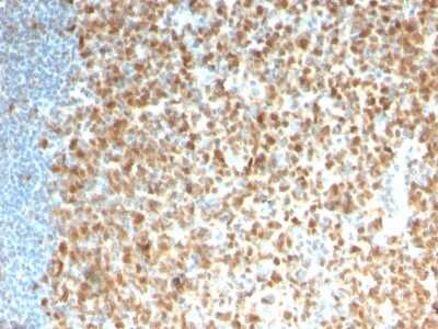 Immunohistochemistry-Paraffin: MCM7 Antibody (rMCM7/1468) - Azide and BSA Free [NBP3-08389]