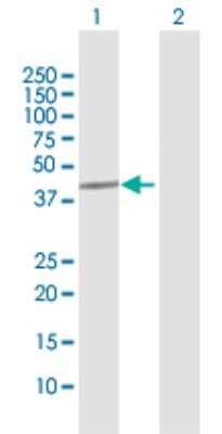 Western Blot: MCM9 Antibody [H00254394-D01P]