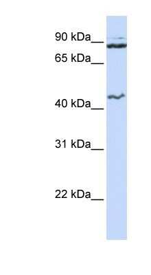Western Blot: MCM9 Antibody [NBP1-58128]