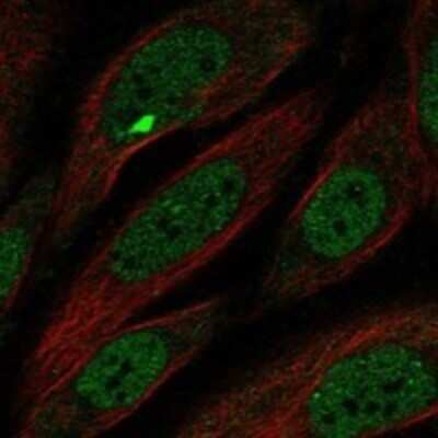 Immunocytochemistry/ Immunofluorescence: MCPH1 Antibody [NBP3-17888]