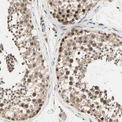 Immunohistochemistry-Paraffin: MCPH1 Antibody [NBP1-89937]