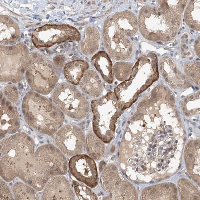 Immunohistochemistry-Paraffin: MCPIP1/ZC3H12A Antibody [NBP1-83587]