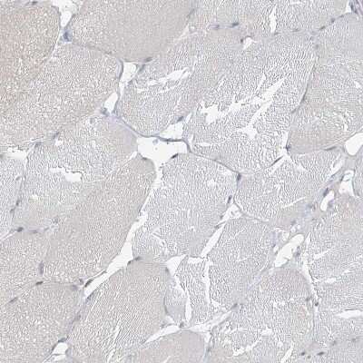 Immunohistochemistry-Paraffin: MCPIP1/ZC3H12A Antibody [NBP2-37871]