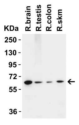 Western Blot: MCPIP1/ZC3H12A AntibodyBSA Free [NBP3-18333]