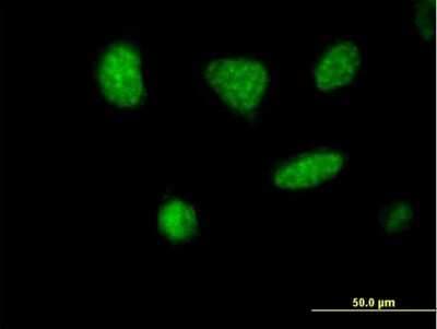 Immunocytochemistry/ Immunofluorescence: MCRS1 Antibody [H00010445-B01P]