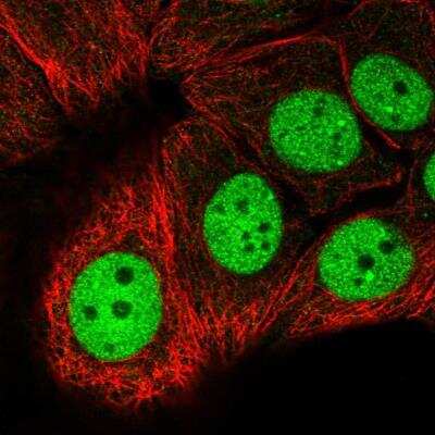 Immunocytochemistry/ Immunofluorescence: MCRS1 Antibody [NBP1-81615]