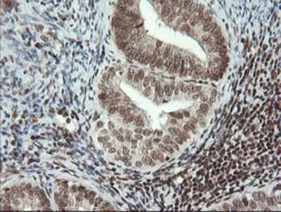 Immunohistochemistry-Paraffin: MCTS1 Antibody (OTI2F9) [NBP2-03626]