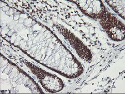 Immunohistochemistry-Paraffin: MCTS1 Antibody (OTI2F9) [NBP2-03626]
