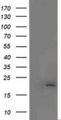 Western Blot: MCTS1 Antibody (OTI2F9) [NBP2-03626]