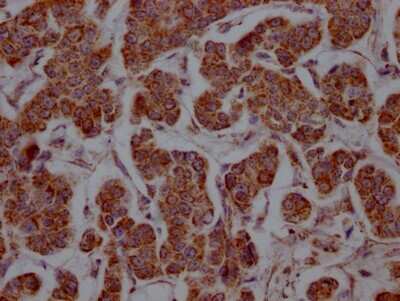 Immunohistochemistry: MCT1/SLC16A1 Antibody (9D12) [NBP3-15184]