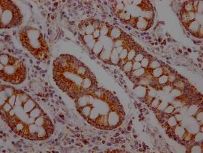 Immunohistochemistry: MCT1/SLC16A1 Antibody (9D12) [NBP3-15184]