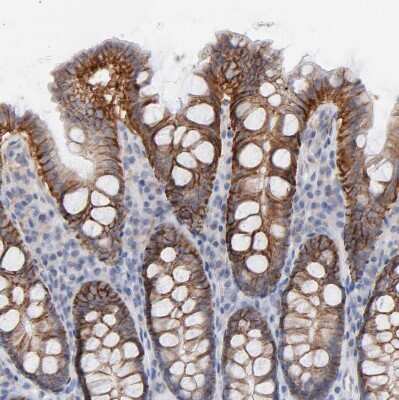 Immunohistochemistry-Paraffin: MCT1/SLC16A1 Antibody [NBP1-89574]