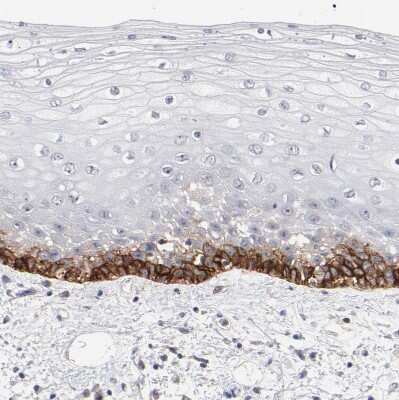 Immunohistochemistry-Paraffin: MCT1/SLC16A1 Antibody [NBP1-89574]