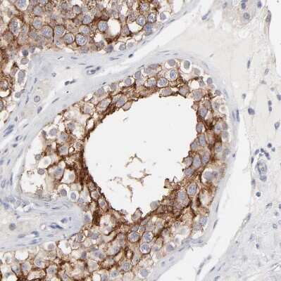 Immunohistochemistry-Paraffin: MCT1/SLC16A1 Antibody [NBP1-89574]