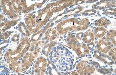 Immunohistochemistry-Paraffin: MCT3/SLC16A8 Antibody [NBP1-59885]