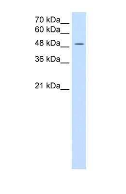 Western Blot: MCT3/SLC16A8 Antibody [NBP1-59885]