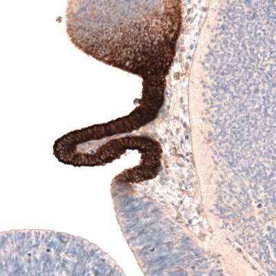 Immunohistochemistry-Paraffin: MCT8/SLC16A2 Antibody [NBP2-57308]