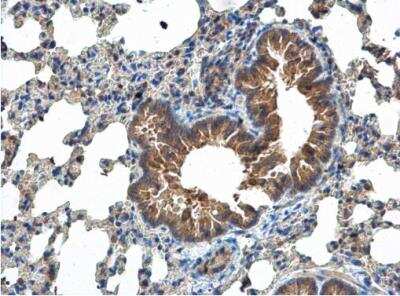Immunohistochemistry-Paraffin: MCTS1 Antibody [NBP2-17242]