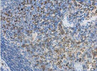 Immunohistochemistry-Paraffin: MCTS1 Antibody [NBP2-17242]