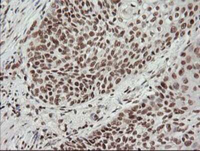 Immunohistochemistry: MCTS1 Antibody (OTI2F9) - Azide and BSA Free [NBP2-72603]