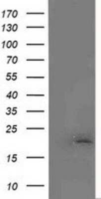 Western Blot: MCTS1 Antibody (OTI2F9)Azide and BSA Free [NBP2-72603]