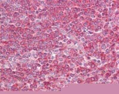 Immunohistochemistry-Paraffin: MD-1/LY86 Antibody [NB100-56700]