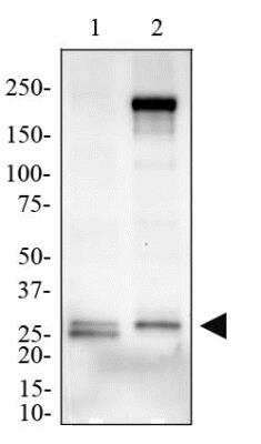 Western Blot: MD-2 Antibody [NB100-56655]