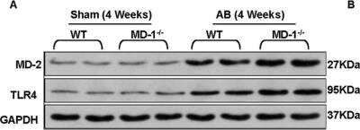 Western Blot: MD-2 Antibody [NB100-56655]
