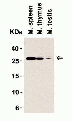 Western Blot: MD-2 AntibodyBSA Free [NBP1-77201]