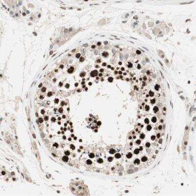 Immunohistochemistry-Paraffin: MDC1 Antibody [NBP1-84860]