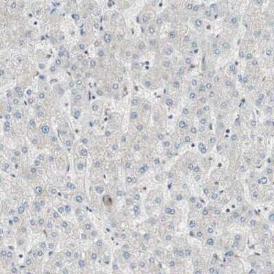 Immunohistochemistry-Paraffin: MDC1 Antibody [NBP1-84860]