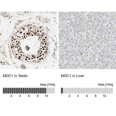 Immunohistochemistry-Paraffin: MDC1 Antibody [NBP1-84860]