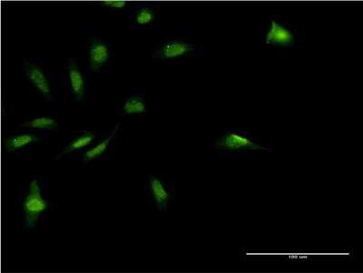 Immunocytochemistry/ Immunofluorescence: MDFI Antibody (3B4) [H00004188-M07]