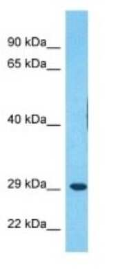 Western Blot: MDFI Antibody [NBP3-09275]