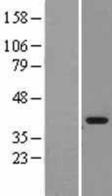 Western Blot: MDH1 Overexpression Lysate [NBL1-12964]