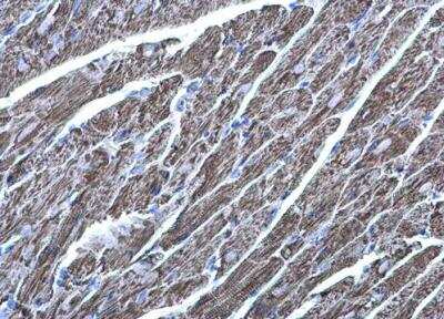 Immunohistochemistry-Paraffin: MDH2 Antibody [NBP1-32259]