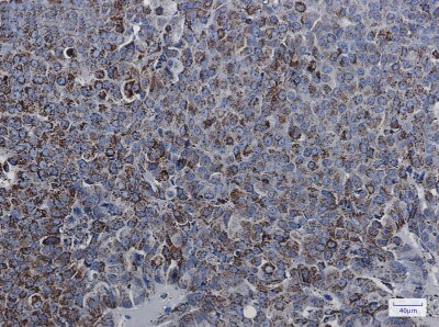 Immunohistochemistry-Paraffin: MDH2 Antibody (S05-4B5) [NBP3-19686]