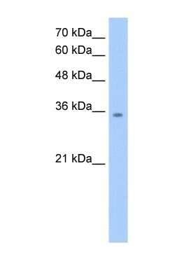 Western Blot: MDH2 Antibody [NBP1-54649]