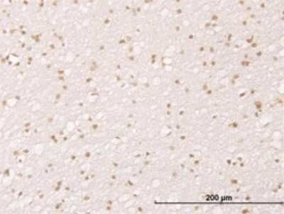 Immunohistochemistry-Paraffin: MDM2/HDM2 Antibody (1A7) [H00004193-M01]