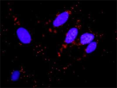 Proximity Ligation Assay: MDM2/HDM2 Antibody (1A7) [H00004193-M01]