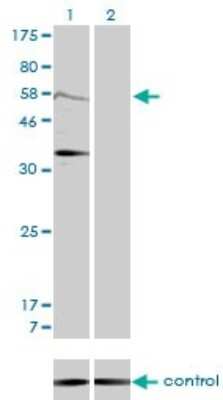 Western Blot: MDM2/HDM2 Antibody (1A7) [H00004193-M01]