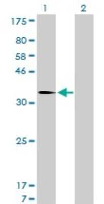 Western Blot: MDM2/HDM2 Antibody (1A7) [H00004193-M01]