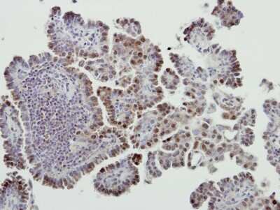 Immunohistochemistry-Paraffin: MDM2/HDM2 Antibody [NBP2-17247]