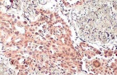 Immunohistochemistry-Paraffin: MDM2/HDM2 Antibody [NBP2-17247]