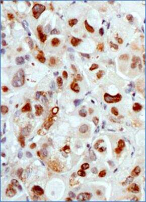 Immunohistochemistry-Paraffin: MDM2/HDM2 Antibody (SMP14) - BSA Free [NB100-2736]