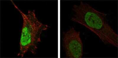 Immunocytochemistry/ Immunofluorescence: MDMX Antibody (2D10F4) - BSA Free [NBP1-28862]