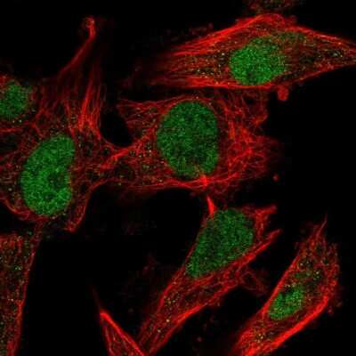 Immunocytochemistry/ Immunofluorescence: MDMX Antibody [NBP2-58791]