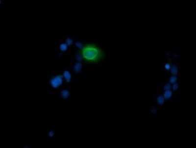 Immunocytochemistry/ Immunofluorescence: MDMX Antibody (OTI4G5) - Azide and BSA Free [NBP2-72605]